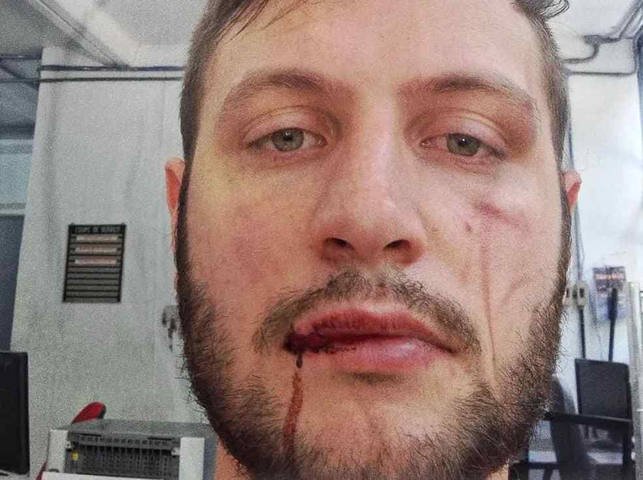 Francisco Napolitano, estudante de Letras que afirmou, em seu Instagram, ter sido agredido por seguranças de Pavanato — Foto: Reprodução/ Redes Sociais