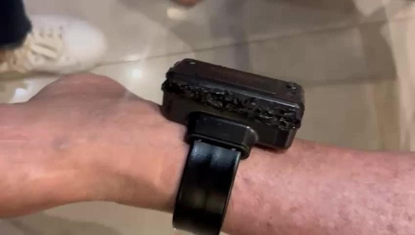 Curiosidade, vergonha e alucinação: as versões sobre a violação de tornozeleira eletrônica por Bolsonaro